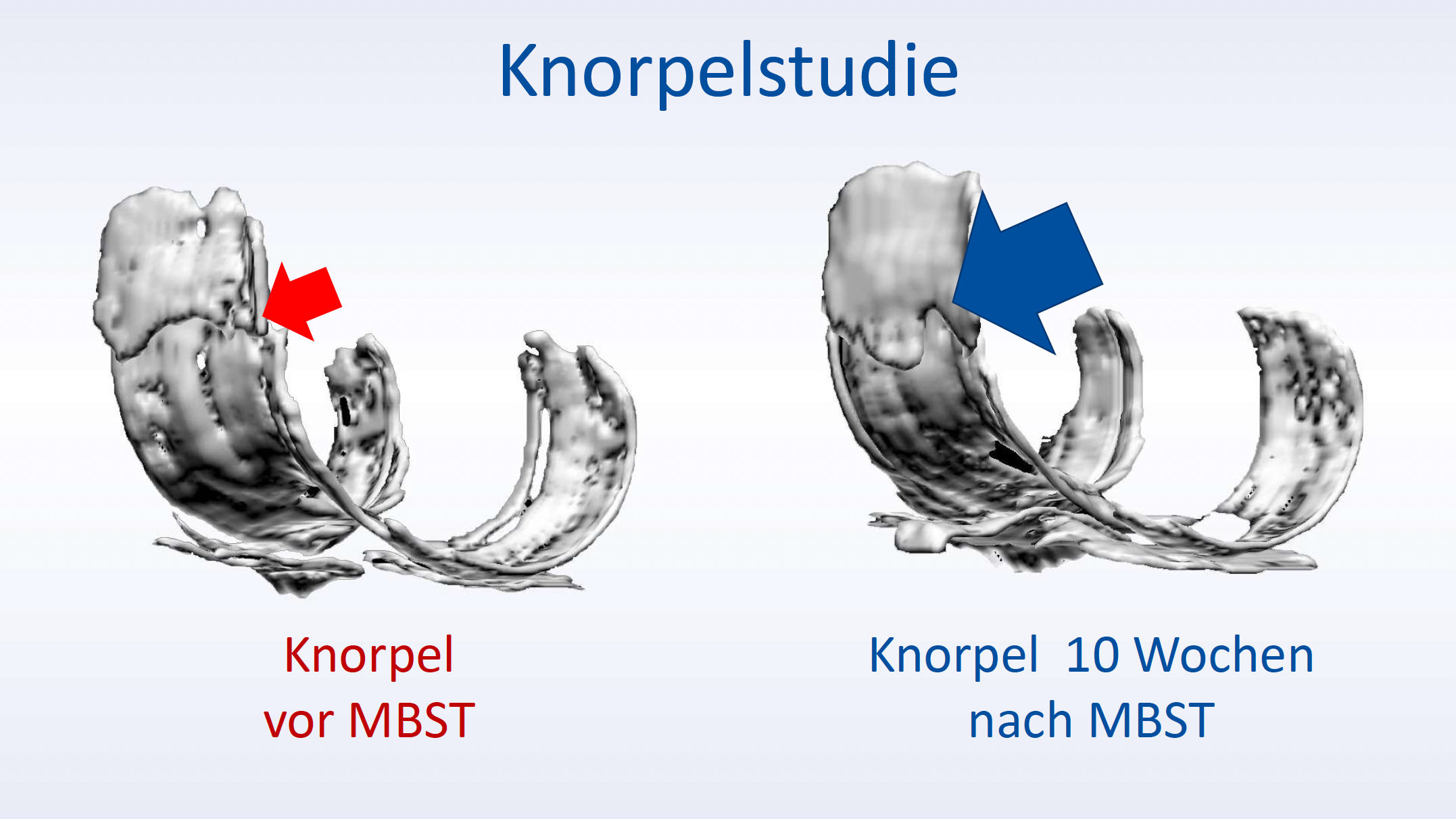 Dr. med Marcus Netzel - Kernspinresonanz-Technologie - Grafik 1